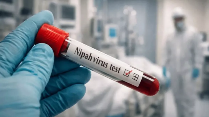 virus nipah
